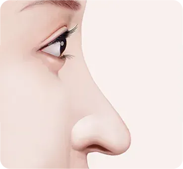 긴코 · 화살코성형 과정 - 1. 수술 전