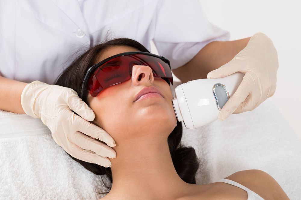 A Woman Is Getting A Laser Hair Removal Treatment On Her Face — Mackay Skin Clinic In Hamilton Island, QLD