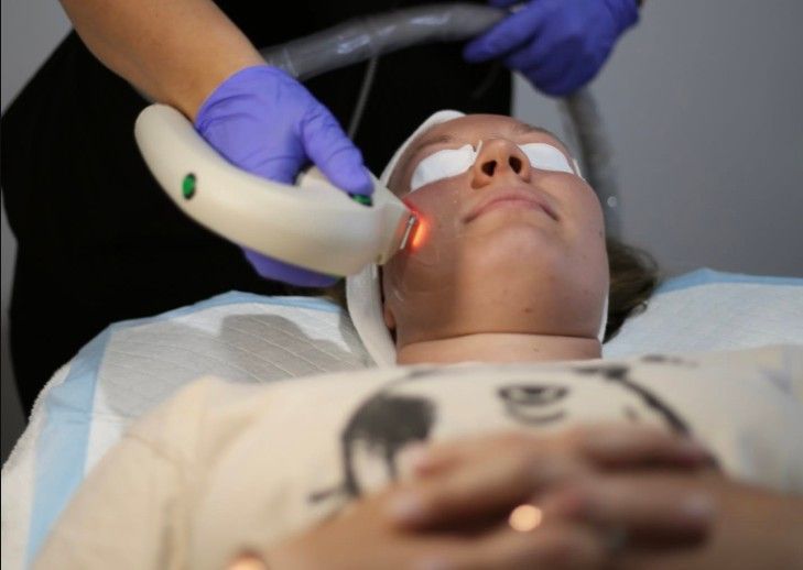 Facial Mackay Advanced Skin Rejuvenation Treatment Session
