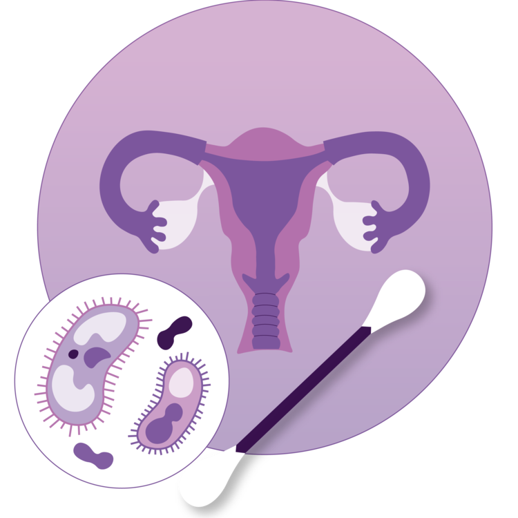Illustration of female reproductive system with magnified bacteria and swab.