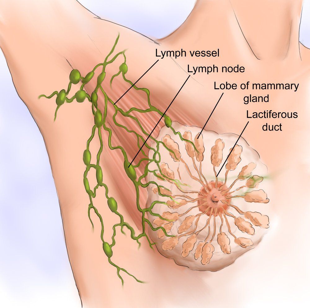 Diagram of a breast showing lymph vessels and nodes, lobes, and ducts.