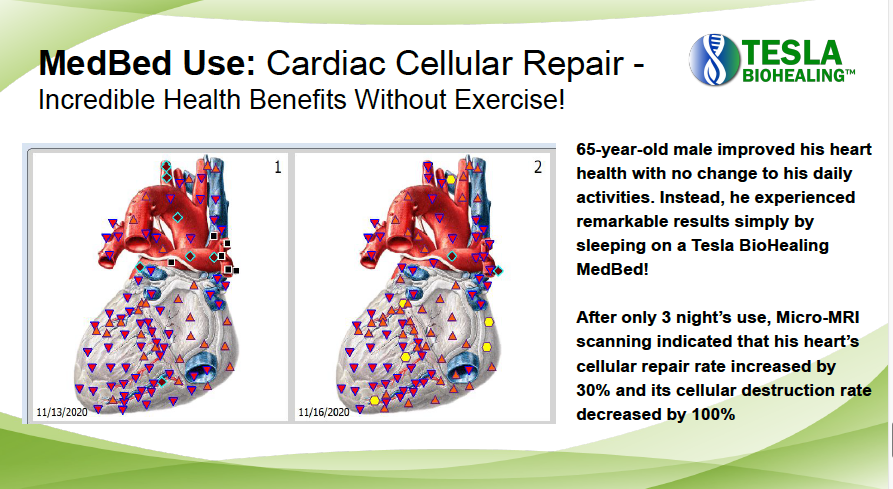 Slide showing heart diagrams. Claims MedBed use repairs cardiac cells. Text indicates health benefits without exercise.