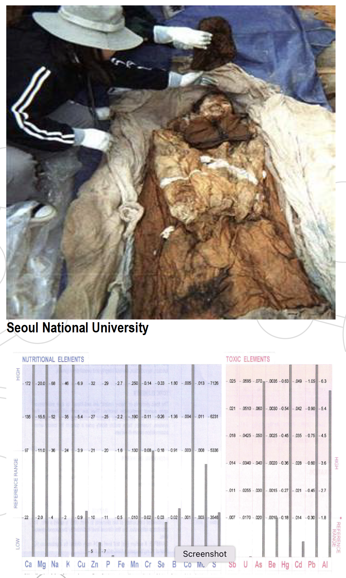 Mummified body in layered clothing, being examined. Scientist in protective wear, with a chart detailing the body.