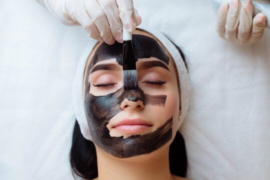 Microneedling