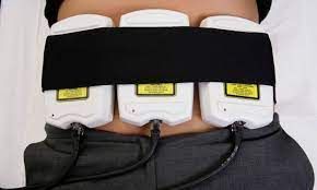 Microneedling