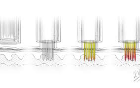 Microneedling