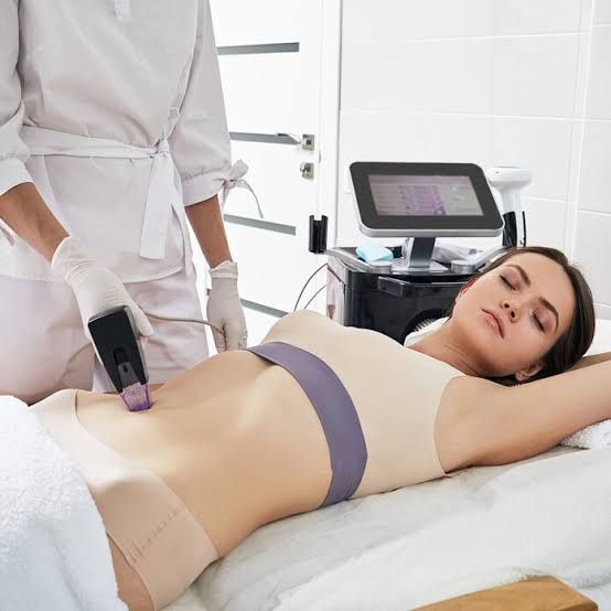 Radiofrequenz Microneedling