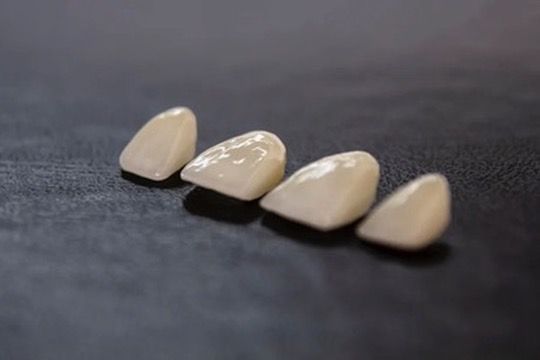 Un gros plan d'une rangée de couronnes dentaires sur une surface noire.