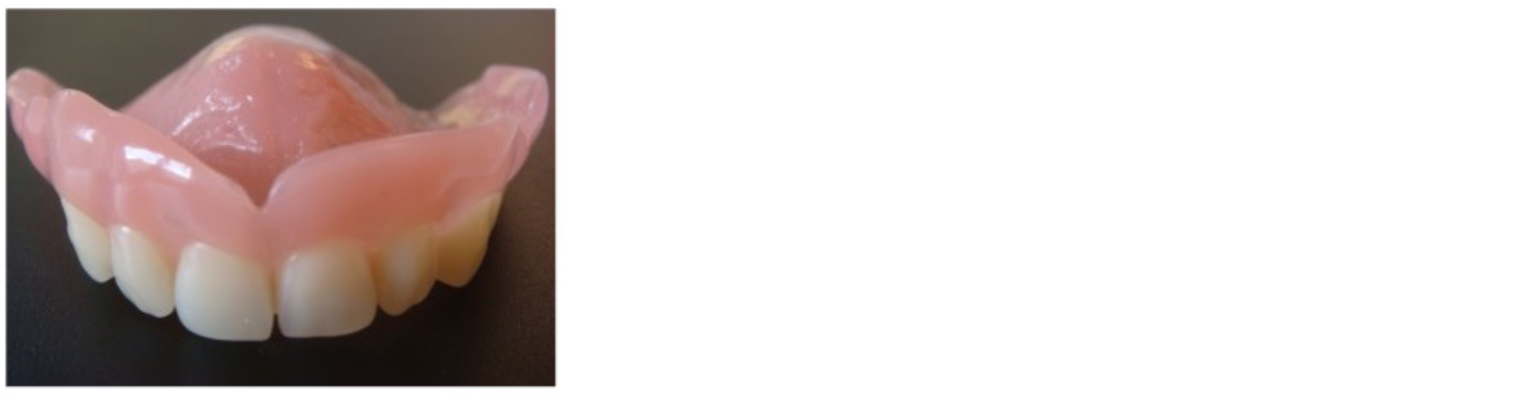 Un gros plan d'une paire de prothèses dentaires sur une table.