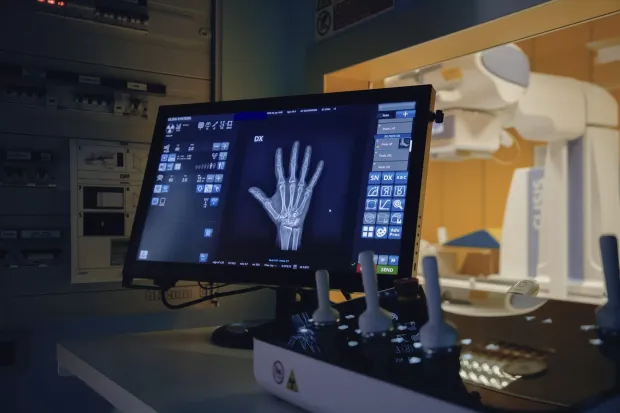 Radiografia di una mano visualizzata su un monitor in una stanza di diagnostica per immagini scarsamente illuminata.
