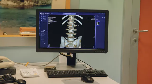 Monitor di computer che visualizza una radiografia della colonna vertebrale su una scrivania con tastiera e mouse.