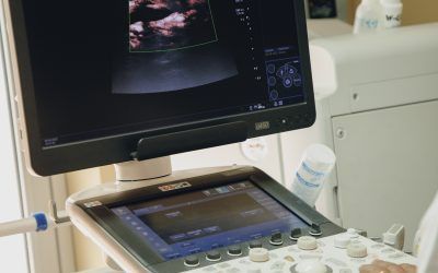 Apparecchio ecografico con monitor che visualizza l'immagine in una stanza clinica.