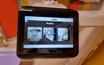 Schermo di un tablet che mostra tre immagini ecografiche in un ambiente clinico.