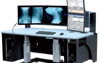Postazione di lavoro per diagnostica per immagini medicali con tre monitor che visualizzano le radiografie su una scrivania