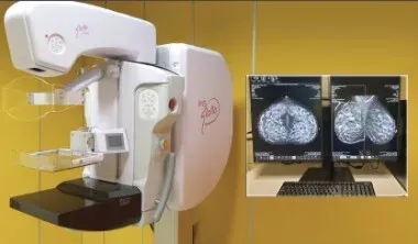 Apparecchio per mammografia accanto a due monitor che mostrano le immagini delle mammografie su una parete gialla.