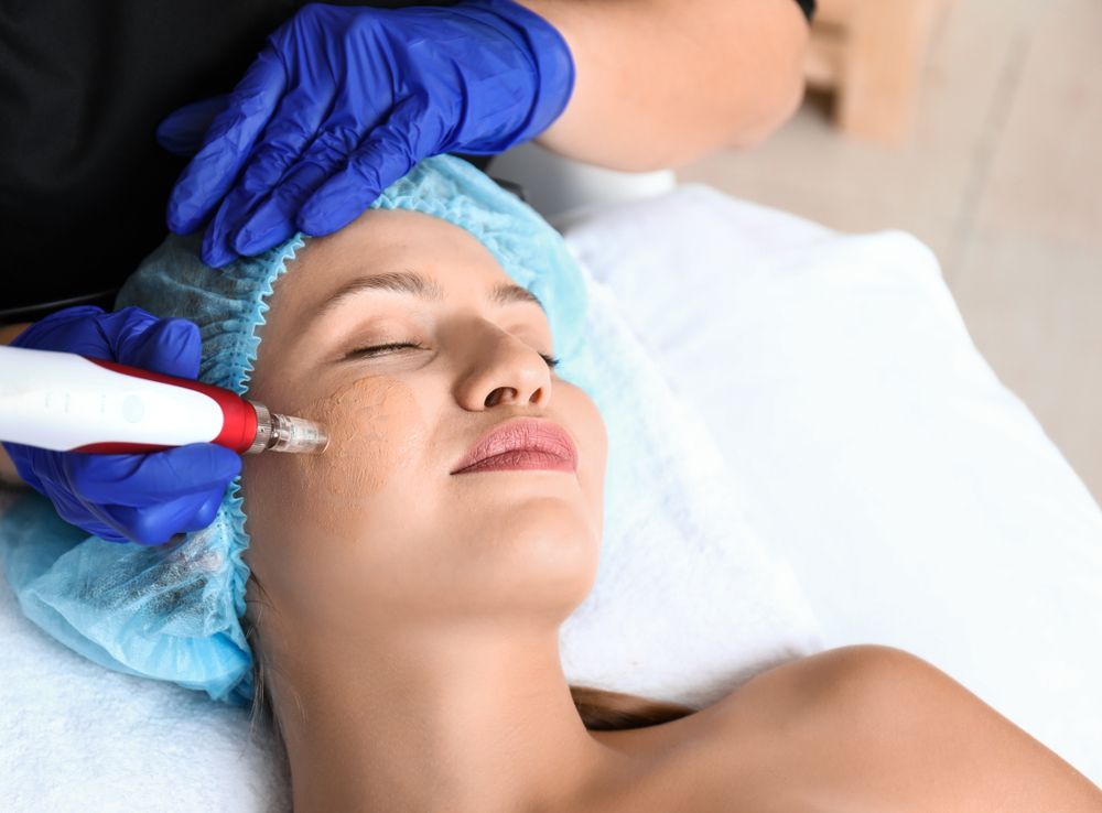 Woman Receiving Microneedling Treatment on Her Face — Bombshell Body Bar In Meikleville Hill, QLD