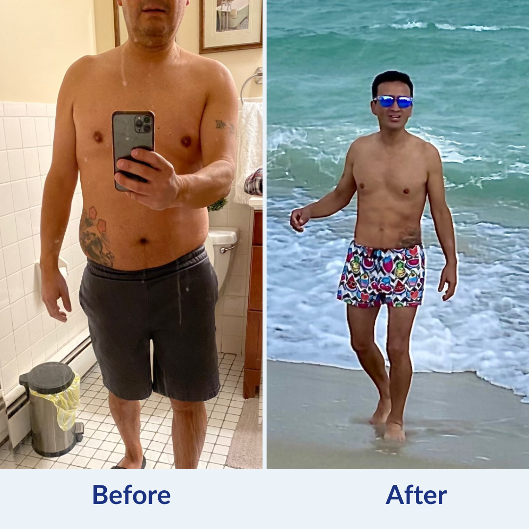 Semaglutide Before & After 1