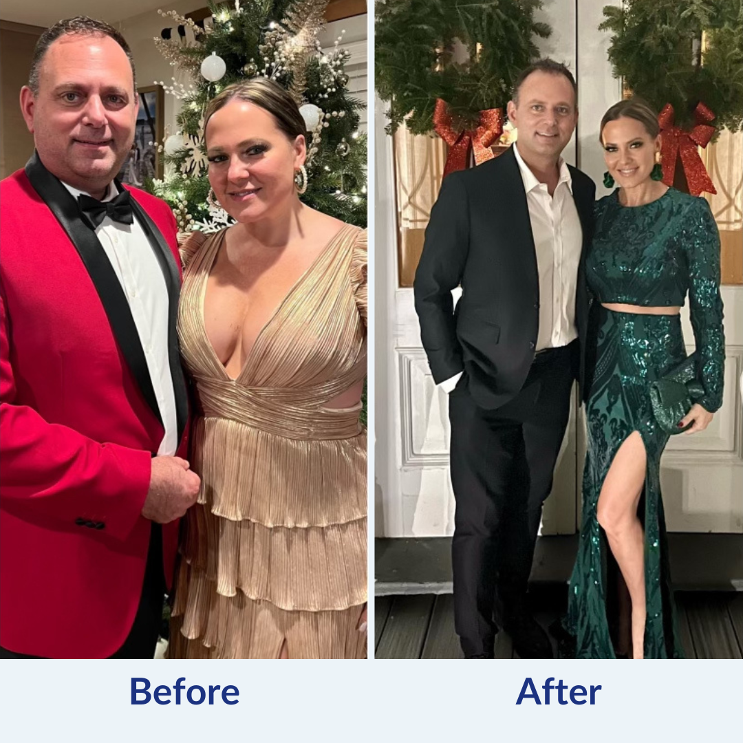 Semaglutide Before & After 2
