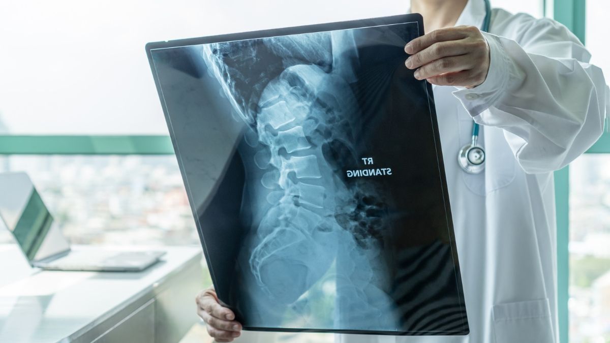 Chirurgia Vertebrale Poliambulatorio IGEA Piacenza