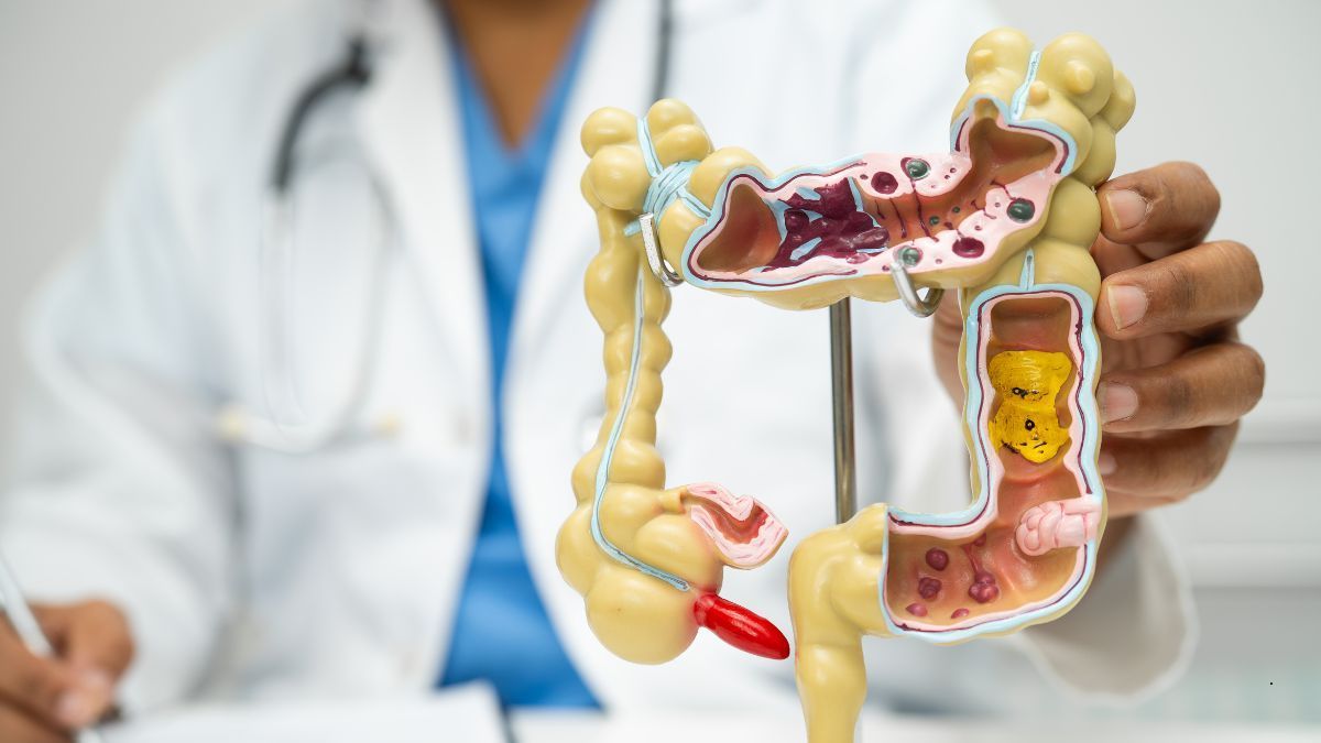 Long COVID Infiammazione e Proteina Spike | Poliambulatorio IGEA Piacenza Malattie Infiammatorie Croniche Intestinali (MICI), Colon Irritabile e Sistema Immunitario | Poliambulatorio IGEA Piacenza