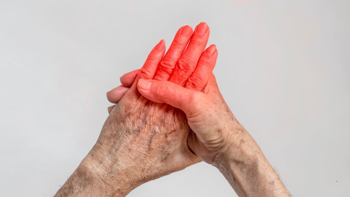 Sindrome del Tunnel Carpale: Cause, Sintomi e Trattamenti | Poliambulatorio IGEA Piacenza ARTRITE PSORIASICA – QUANDO DOLORI ARTICOLARI E PSORIASI SI INCONTRANO | Poliambulatorio IGEA Piacenza
