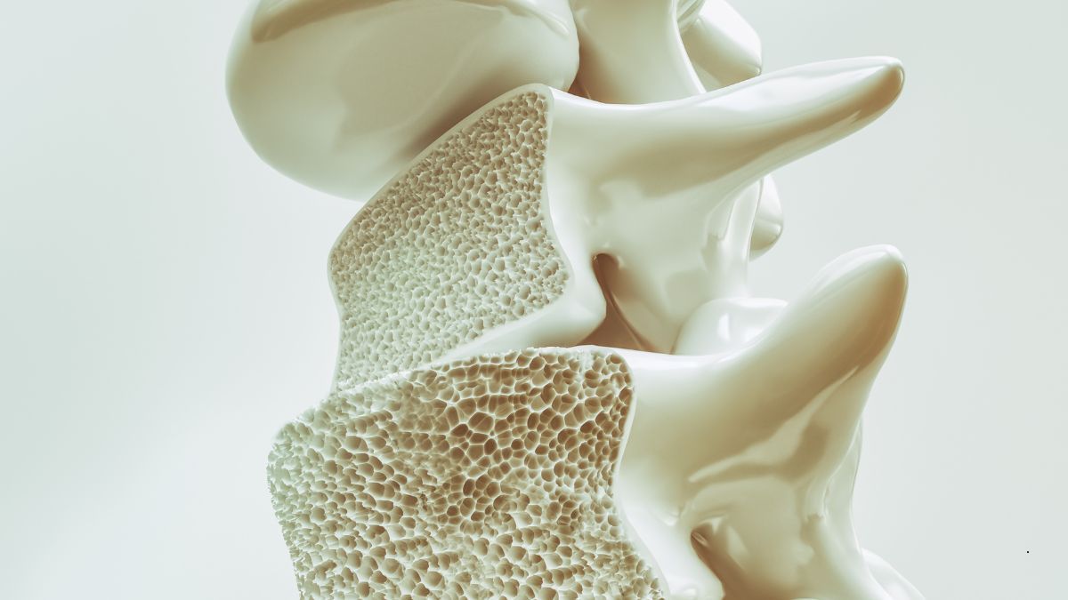 Sindrome del Tunnel Carpale: Cause, Sintomi e Trattamenti | Poliambulatorio IGEA Piacenza OSTEOPOROSI – LA MALATTIA SILENZIOSA DELLE OSSA FRAGILI | Poliambulatorio IGEA Piacenza
