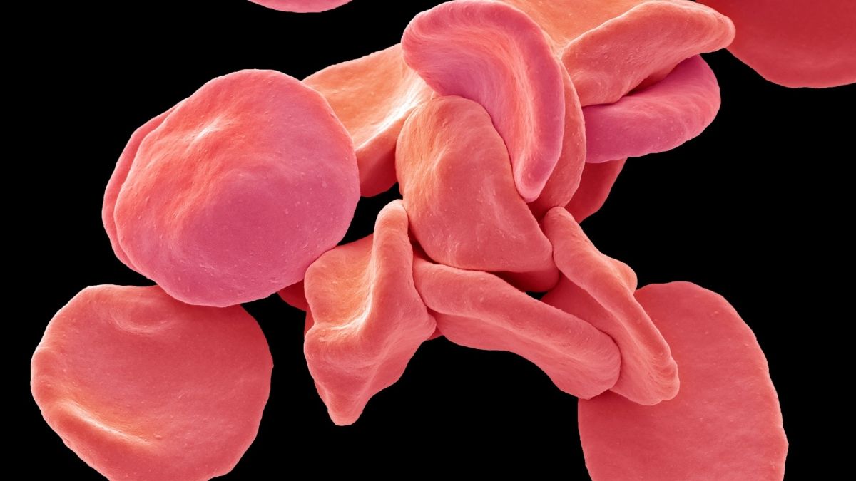 Riconoscere i Segnali Premonitori delle Patologie dell'Apparato Vascolare: Quando Consultare il Prof. Giovanni Nano, Chirurgo Vascolare del Poliambulatorio IGEA Piacenza