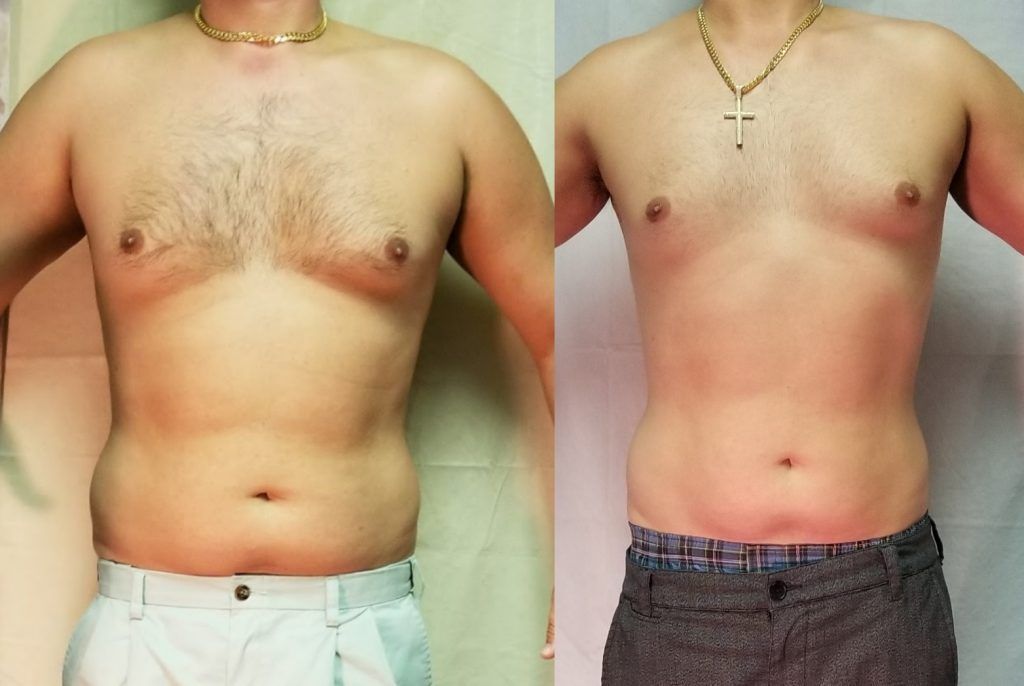 Side-by-side torso comparison of a shirtless person before and after weight loss.