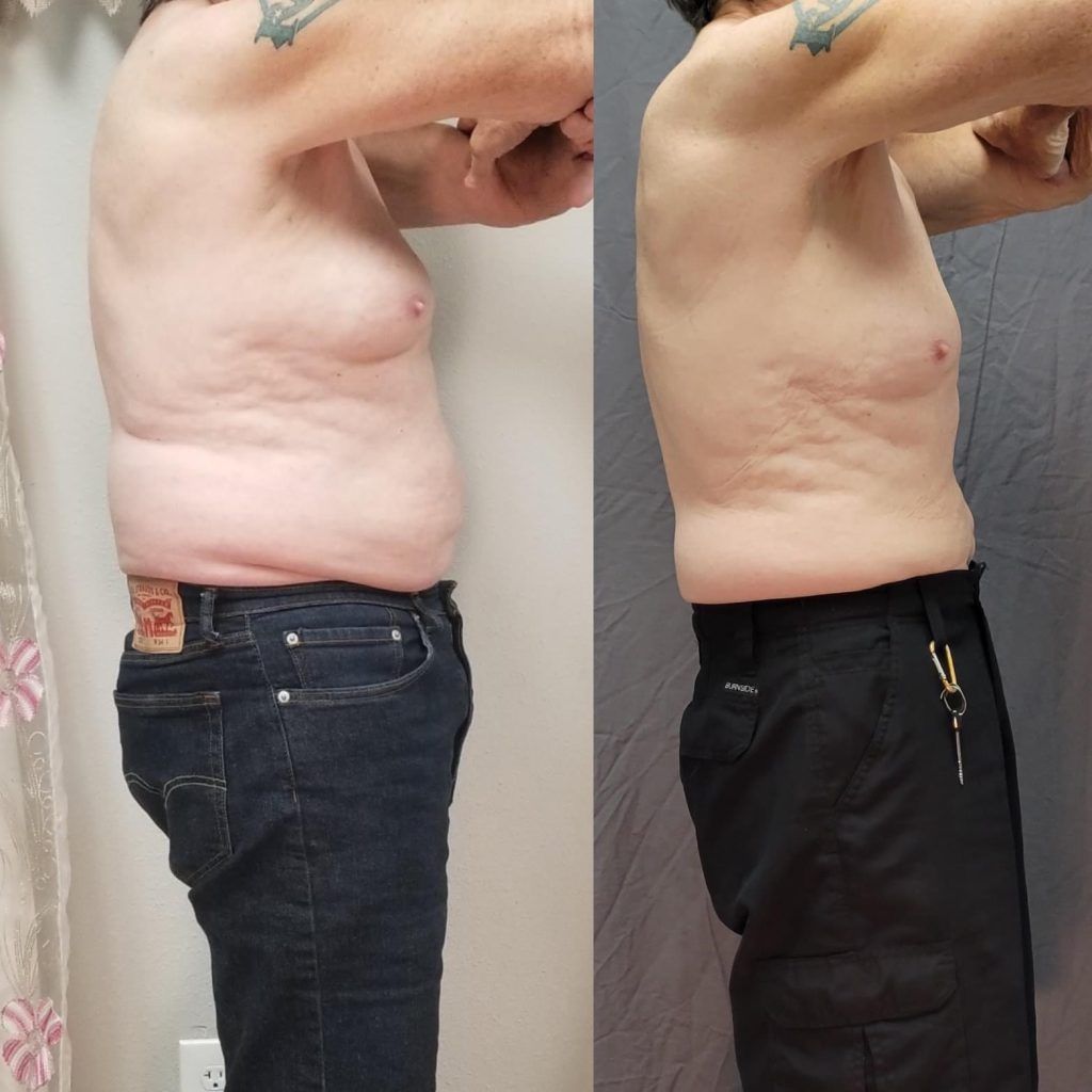 Side-by-side profile photos of a shirtless person showing a slimmer torso and flatter stomach after weight loss