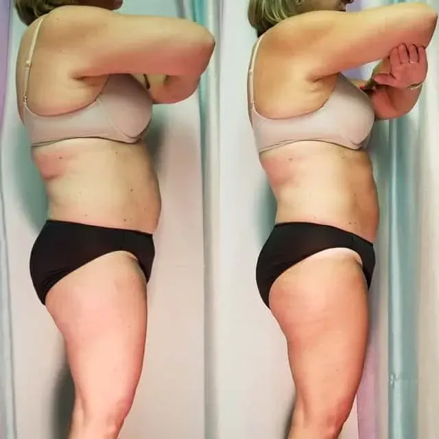 Side-by-side profile photos of a person in underwear, showing a bent-arm pose against a plain wall.