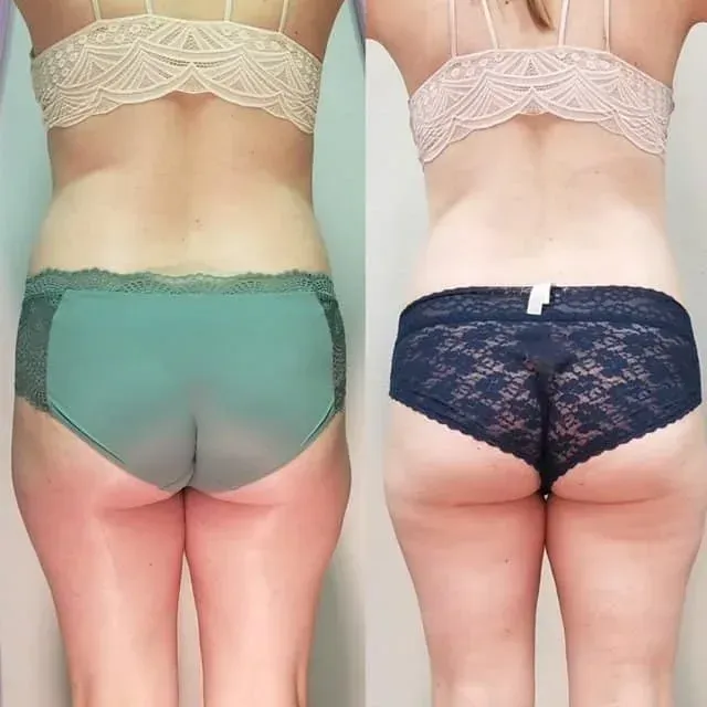 Side-by-side back view of two women in lace lingerie, one in green and one in black.