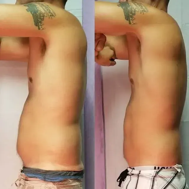 Side-by-side torso photos of a shirtless person showing a slimmer profile and posture comparison