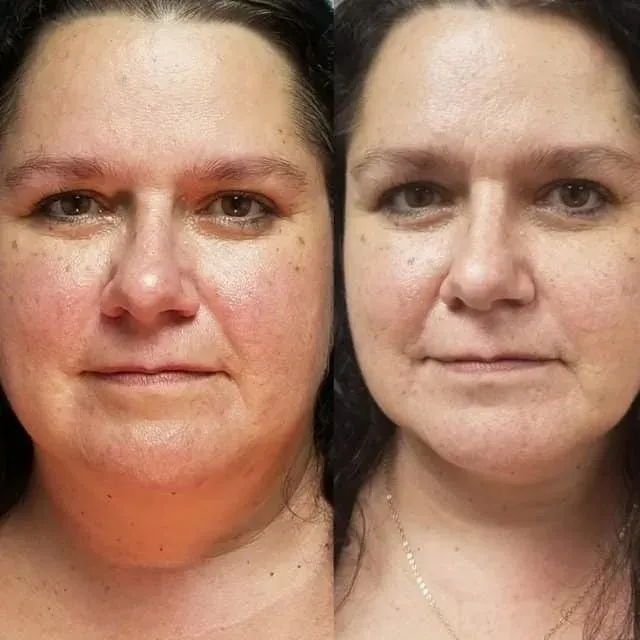 Side-by-side portrait showing a woman's face before and after a makeup or skin treatment comparison.