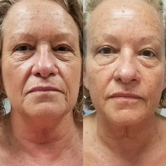Side-by-side portrait of a woman, one unretouched and one smoothed, against a plain background