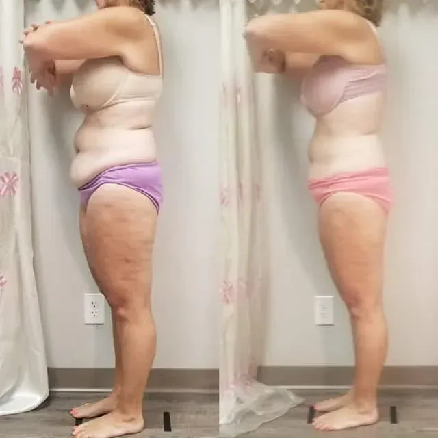 Side-by-side photos of a person in underwear, showing a before-and-after side profile in a room.