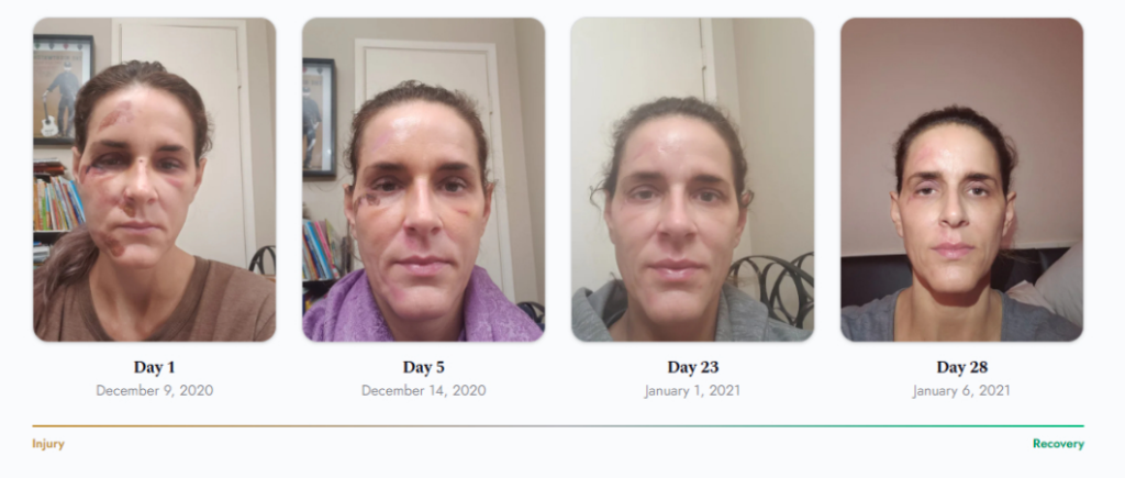 Four side-by-side selfies showing a woman's face at different ages with changing skin tone and wrinkles