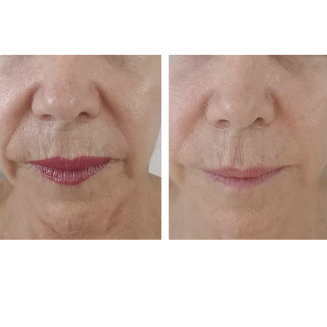 Side-by-side close-up of lips before and after makeup, showing darker lipstick on the left and natural lips on the right