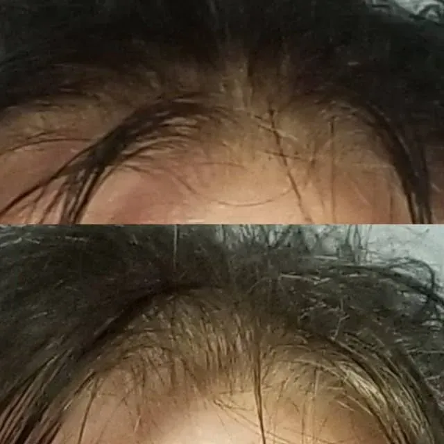 Close-up of tousled dark hair and forehead, split into two stacked views.