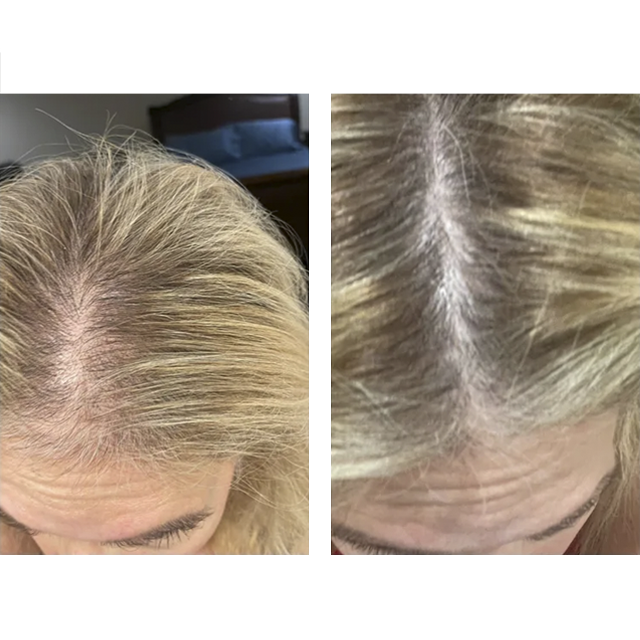 Side-by-side close-up of a scalp part showing thinning gray-blonde hair and a wider hair part line