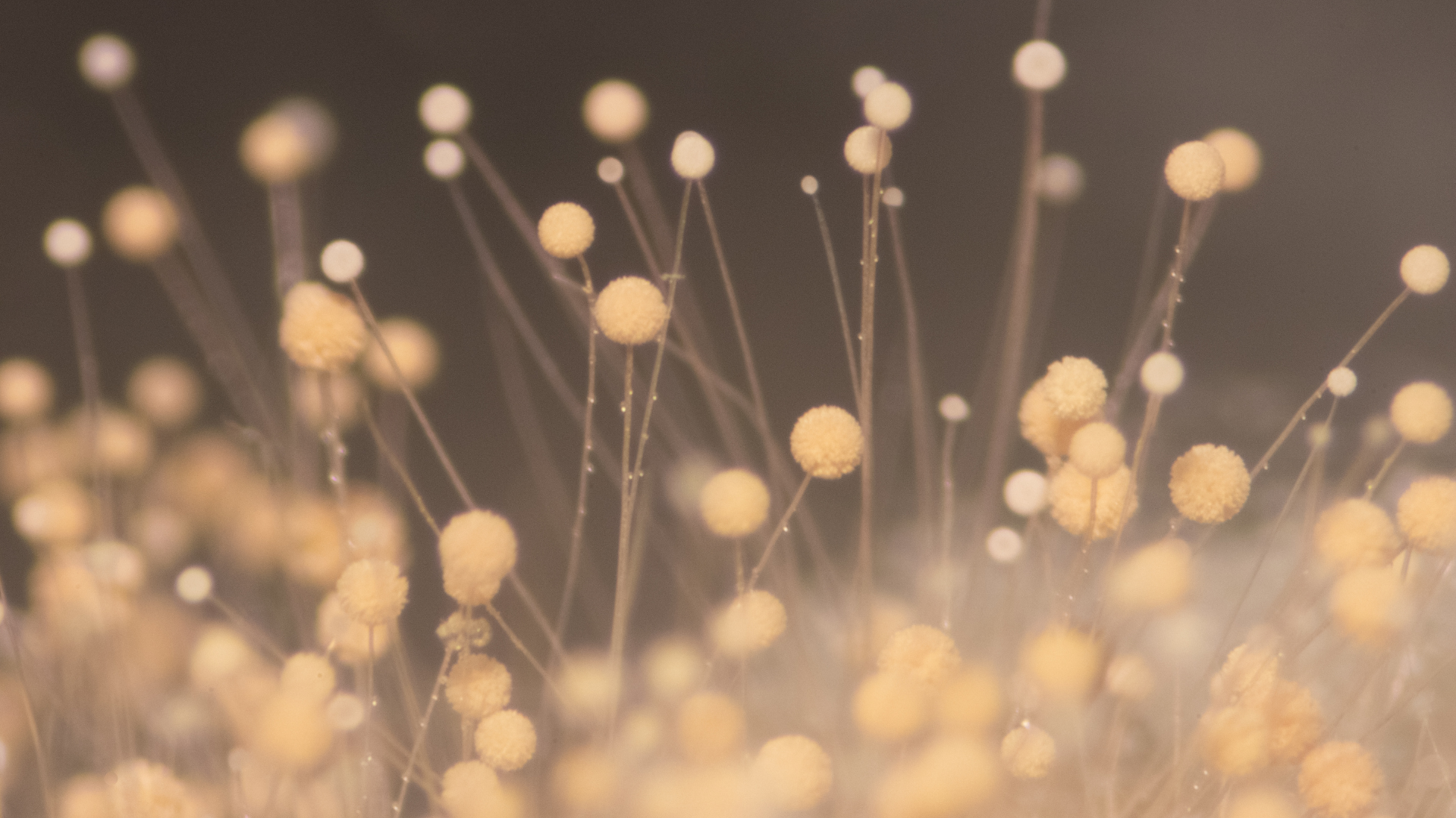 Clusters of small, light-colored, spherical structures on thin stalks, possibly fungal spores, against a dark background.