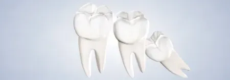 A close up of a dental implant with a tooth in it.