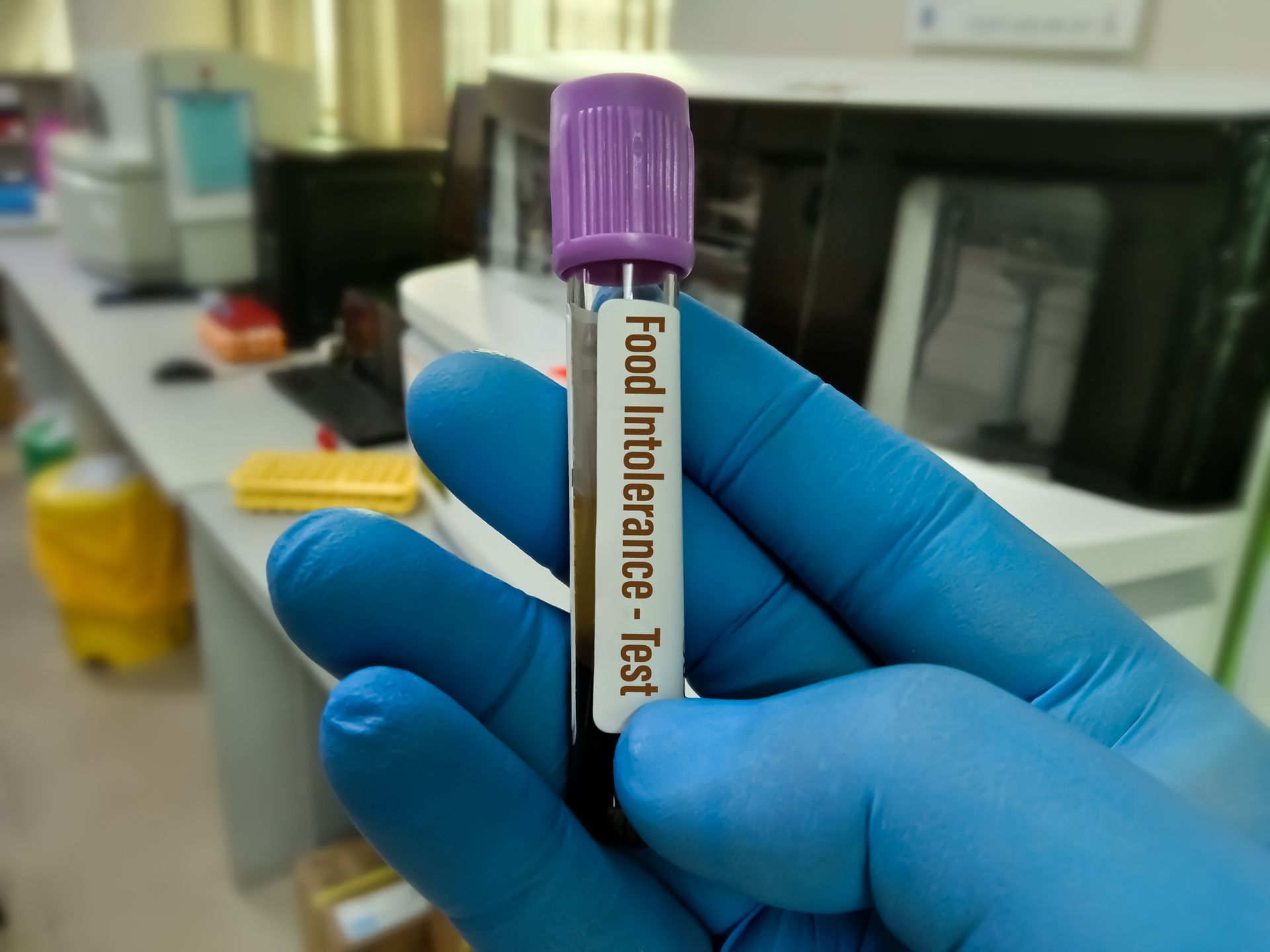 A gloved hand holding a blood sample tube labeled 