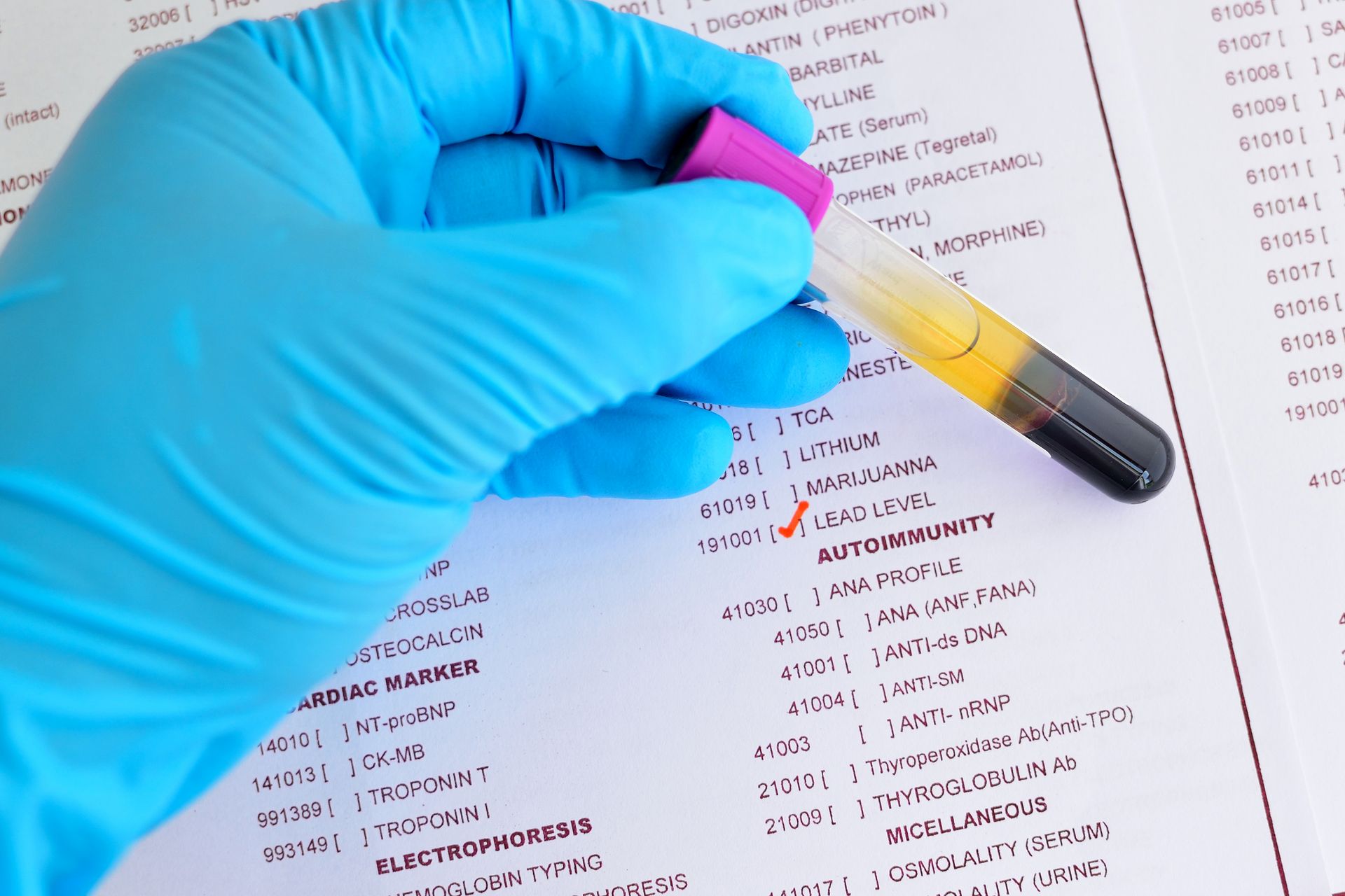 Gloved hand holding a blood sample tube over a lab test form, highlighting 