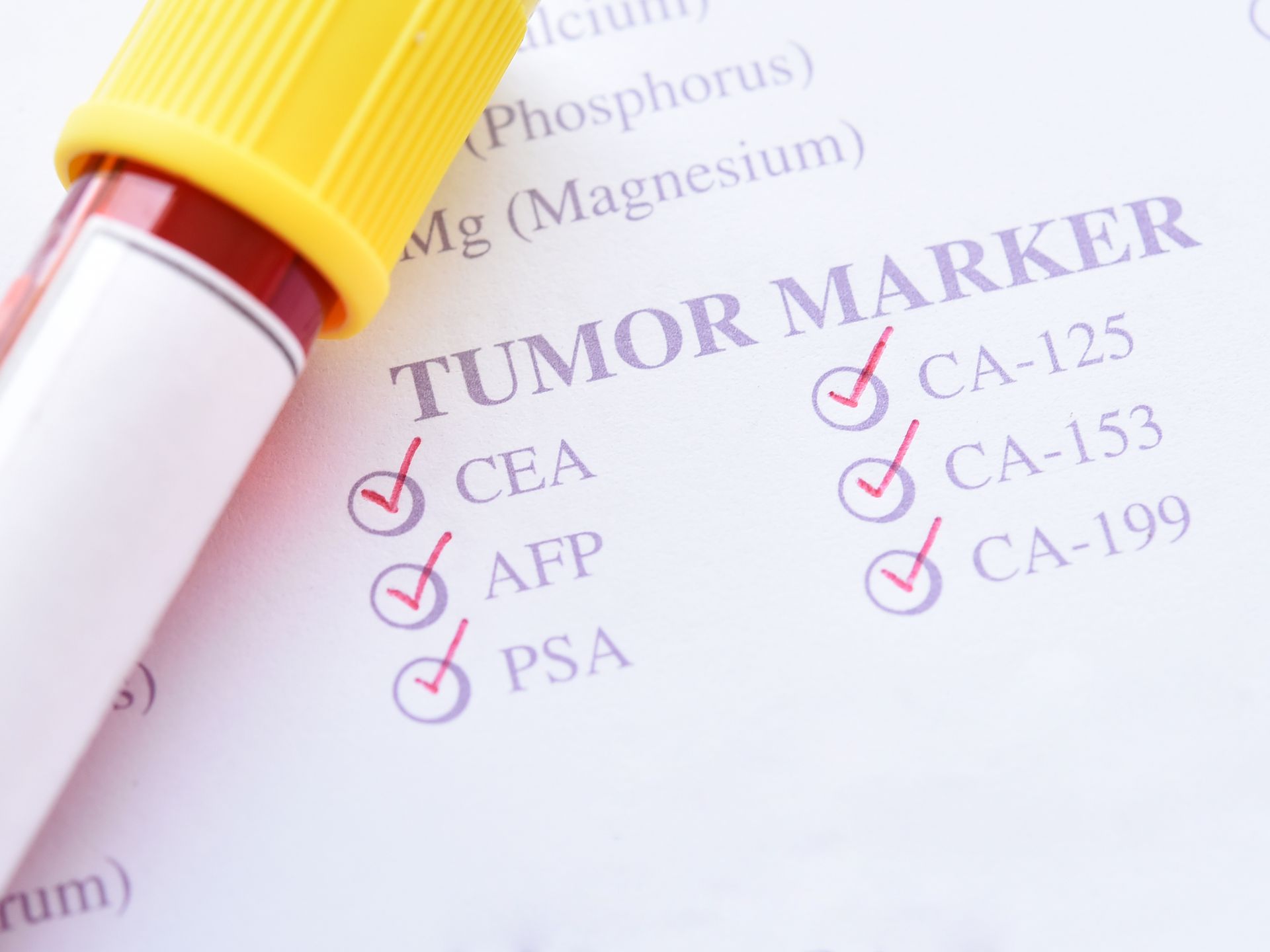 Blood test tube next to a form with checked tumor marker results: CEA, AFP, PSA, CA-125, CA-153, CA-199.