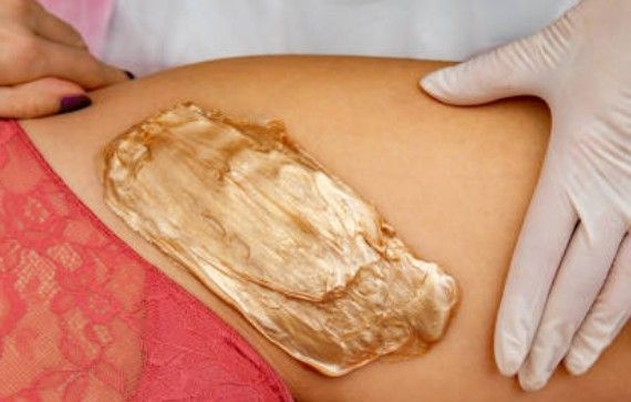 Gloved hands apply a creamy paste to a person’s exposed thigh.