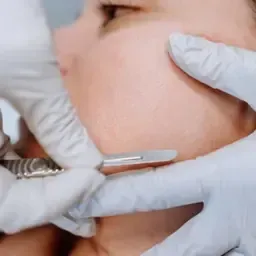 Gloved hands use a dermal filler injection tool on a person’s cheek during a cosmetic treatment.