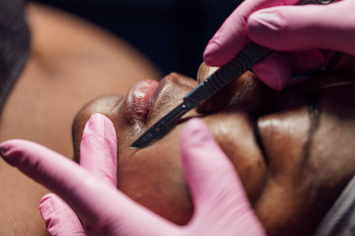 Gloved hands using a black eyebrow tool on a person’s lip in a close-up beauty treatment