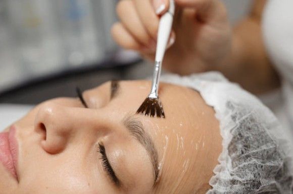 Facial mask being brushed onto a woman’s forehead in a spa treatment