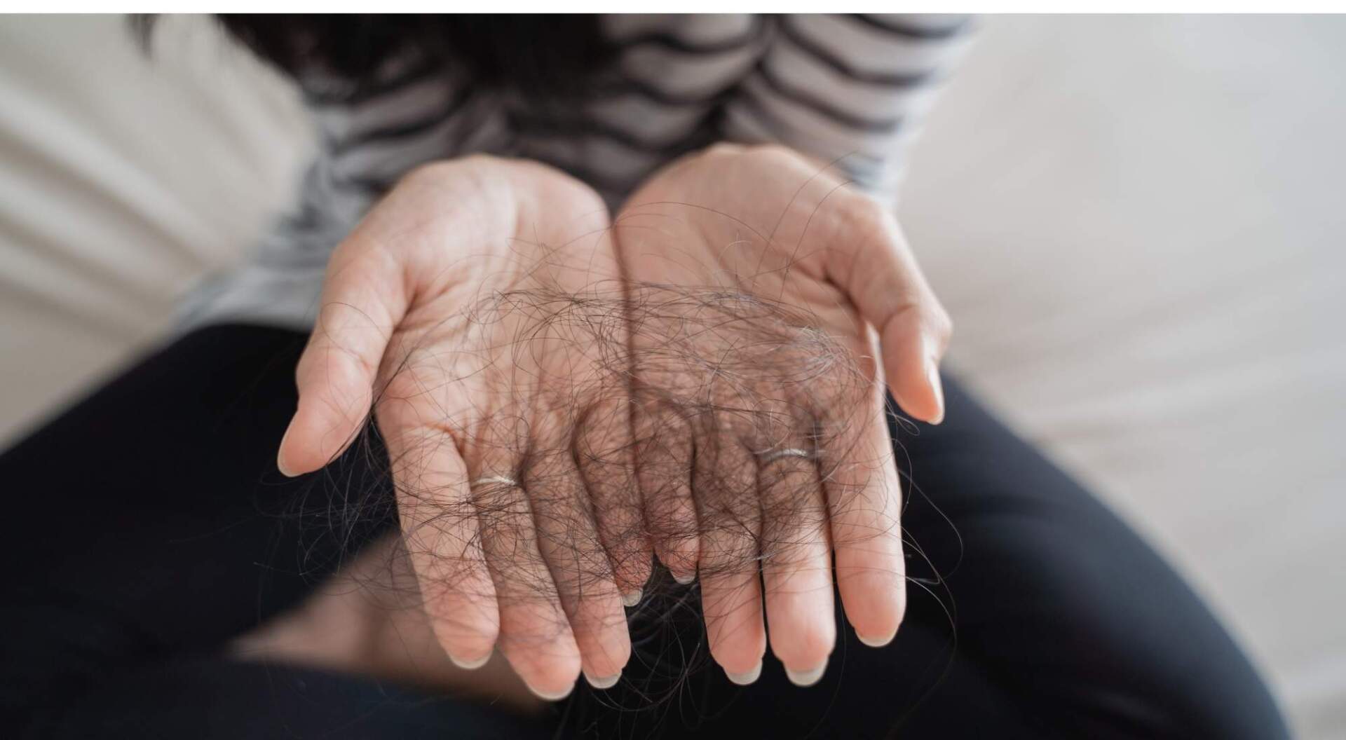 can hormone imbalance cause hair loss