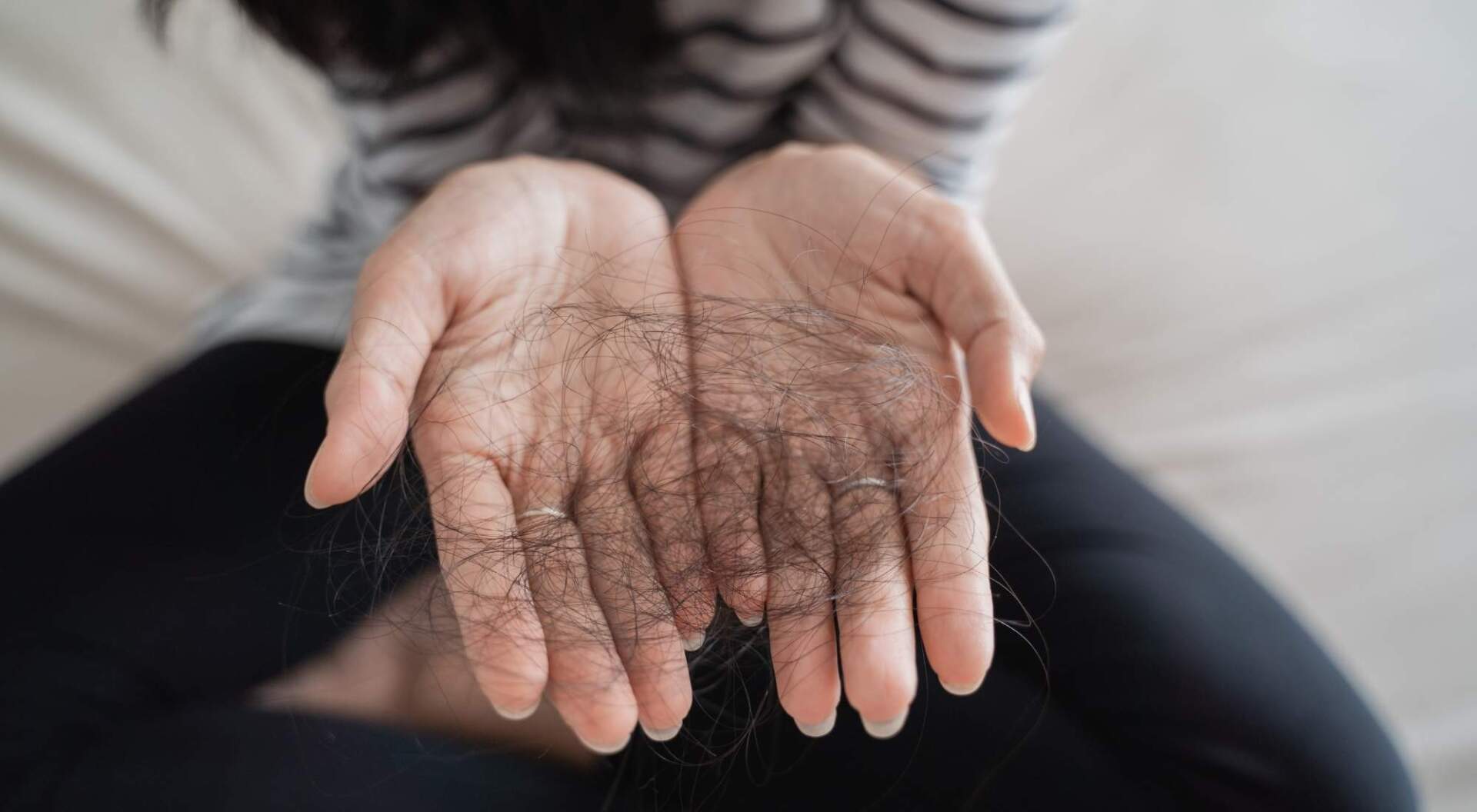 candida cause hair loss